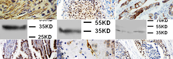 Antibodies_Boster_Interchim_0617