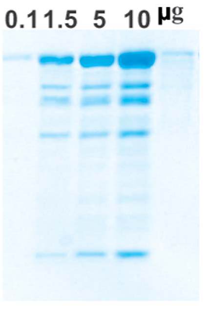 Vignette_Acceuil_Electrophoresis_Uptima_Interchim_0720