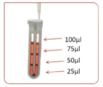 Xpress Dialysis Device