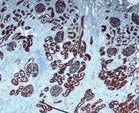 IHC Staining of kidney. / Image under GNU Free Documentation License