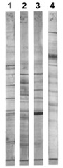 Immunoblot analysis of proteins separated by SDS-PAGE. / Published in Methods in Malaria Research .by Ernst Hempelmann of National Institute of Allergy and Infectious Diseases (NIAID) – Public domain.